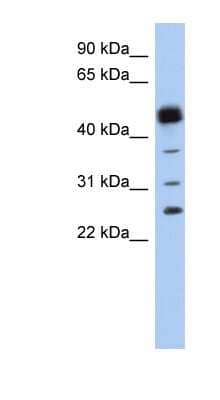 Western Blot: HPGDS Antibody [NBP1-54625] - Titration: 0.2-1 ug/ml, Positive Control: Human Spleen.