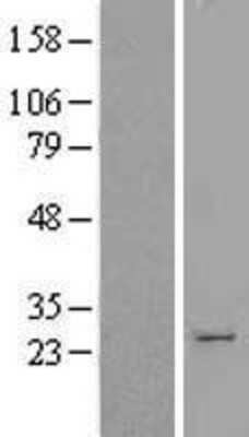 Western Blot: HPGDS Overexpression Lysate (Adult Normal) [NBL1-14330] Left-Empty vector transfected control cell lysate (HEK293 cell lysate); Right -Over-expression Lysate for HPGDS.