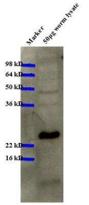 Western Blot: HPL-2 Antibody [38630002] - WB analysis of HPL2 in C. elegans lysate. Image courtesy of anonymous customer product review.