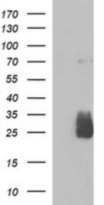 Western Blot: HPRT Antibody (OTI2F7) [NBP2-46003] - Analysis of HEK293T cells were transfected with the pCMV6-ENTRY control (Left lane) or pCMV6-ENTRY HPRT.