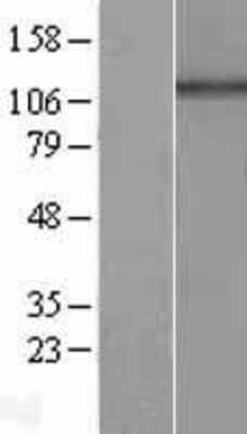 Western Blot: HPS5 Overexpression Lysate (Adult Normal) [NBL1-11699] Left-Empty vector transfected control cell lysate (HEK293 cell lysate); Right -Over-expression Lysate for HPS5.