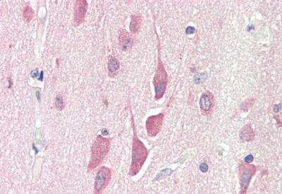 Immunohistochemistry-Paraffin HPS6 Antibody
