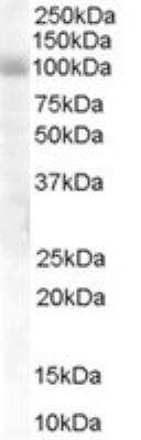 Western Blot HPS6 Antibody