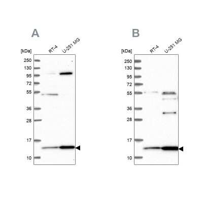 Western Blot HPSC152 Antibody - BSA Free