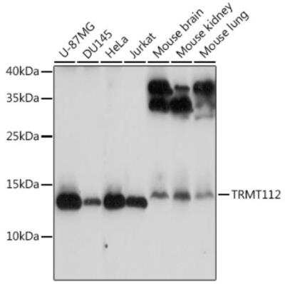 Western Blot: HPSC152 Antibody [NBP3-03251] - Western blot analysis of extracts of various cell lines, using HPSC152 antibody at 1:3000 dilution. Secondary antibody: HRP Goat Anti-Rabbit IgG (H+L) at 1:10000 dilution. Lysates/proteins: 25ug per lane. Blocking buffer: 3% nonfat dry milk in TBST.Detection: ECL Basic Kit. Exposure time: 90s.
