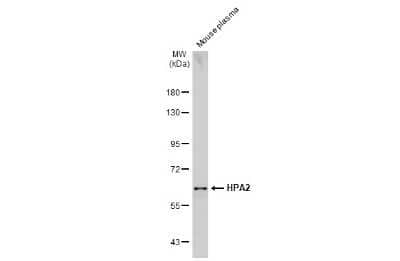 Western Blot: HPSE2 Antibody [NBP3-13420] - Mouse plasma (50 ug) was separated by 7.5% SDS-PAGE, and the membrane was blotted with HPSE2 antibody (NBP3-13420) diluted at 1:5000. The HRP-conjugated anti-rabbit IgG antibody (NBP2-19301) was used to detect the primary antibody.