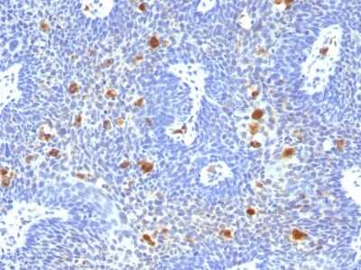 Immunohistochemistry-Paraffin: HPV16 L1 Antibody (HPV16/1296) [NBP2-54510] - Formalin-fixed, paraffin-embedded human Cervix stained with HPV-16 Monoclonal Antibody (HPV16/1296)