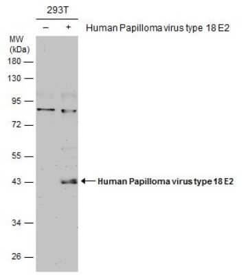Western Blot: HPV18 E2 Antibody [NBP3-13219] - Non-transfected (-) and transfected (+) 293T whole cell extracts (30 ug) were separated by 10% SDS-PAGE, and the membrane was blotted with HPV18 E2 antibody (NBP3-13219) diluted at 1:2000.
