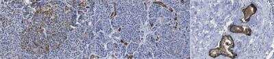 Immunohistochemistry-Paraffin: HPa3 Antibody (HIC3-2D12) [NBP3-18520] - Formalin Fixed Paraffin Embedded (FFPE) human pancreatic tissue sections were prepared using heat-induced epitope retrieval (HIER). Immunostaining was performed using a 1:50 dilution of Cat. No. MABS1998, Anti-HPa3, clone HIC3-2D12. Reactivity was detected using an Rabbit Anti-Mouse and DAB. Cytoplasmic/membranous staining in islets of human pancreas (Left image). membranous staining in intercalated ducts (Middle image), as well as intralobular ducts of human pancreas (Right image) tissues was observed.