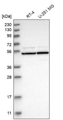 Western Blot: HR23A/Rad23A TUBE1 Antibody [NBP2-68598] - Analysis in human cell line RT-4 and human cell line U-251 MG.