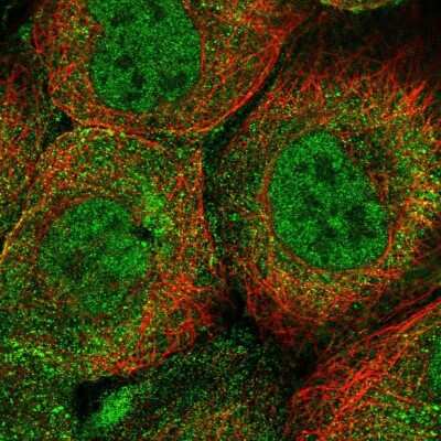 Immunocytochemistry/Immunofluorescence: HR6A/UBE2A Antibody [NBP2-54946] - Staining of human cell line A-431 shows localization to nucleoplasm & vesicles.