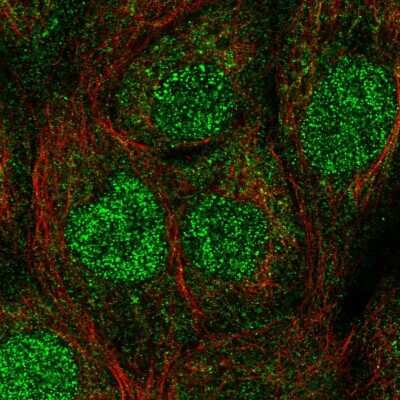 Immunocytochemistry/Immunofluorescence: HR6A/UBE2A Antibody [NBP2-57290] - Staining of human cell line A-431 shows localization to nucleus & plasma membrane.