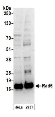 Western Blot: HR6A/UBE2A Antibody [NB100-554] - Detection of Human Rad6 by Western Blot. Samples: Whole cell lysate (50 ug) from HeLa and 293T cells prepared using NETN lysis buffer. Antibody: Affinity purified rabbit anti-Rad6 antibody NB100-554 used for WB at 0.4 ug/ml. Detection: Chemiluminescence with an exposure time of 3 minutes.