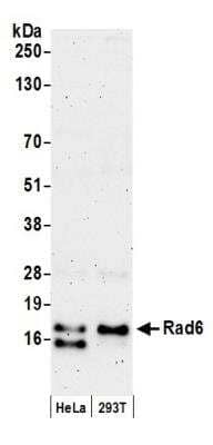 Western Blot: HR6A/UBE2A Antibody [NB100-555] - Detection of Human Rad6 by Western Blot. Samples: Whole cell lysate (50 ug) from HeLa and 293T cells prepared using NETN lysis buffer. Antibody: Affinity purified rabbit anti-Rad6 antibody NB100-555 used for WB at 0.2 ug/ml. Detection: Chemiluminescence with an exposure time of 3 minutes.