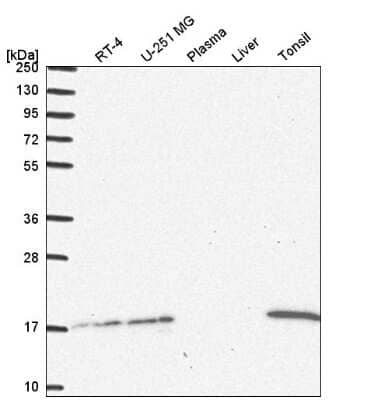 Western Blot: HR6A/UBE2A Antibody [NBP2-54946] - Western blot analysis in human cell line RT-4, human cell line U-251 MG, human plasma, human liver tissue and human tonsil tissue.