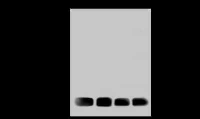 Western Blot: HR6A/UBE2A Antibody [NBP3-00042] - Anti-HR6A/UBE2A rabbit polyclonal antibody at 1:500 dilution. Lane A: HeLa Whole Cell Lysate. Lane B: Jurkat Whole Cell Lysate. Lane C: 293T Whole Cell Lysate. Lane D: COLO205 Whole Cell Lysate. Lysates/proteins at 30 ug per lane. Secondary Goat Anti-Rabbit IgG (H+L)/HRP at 1/10000 dilution. Developed using the ECL technique. Performed under reducing conditions. Predicted band size: 17 kDa. Observed band size: 17 kDa