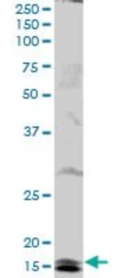 Western Blot: HR6B/UBE2B Antibody [H00007320-B01P] - Analysis of UBE2B expression in Jurkat.