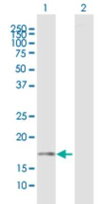 Western Blot: HR6B/UBE2B Antibody [H00007320-B01P] - Analysis of UBE2B expression in transfected 293T cell line by UBE2B polyclonal antibody.  Lane 1: UBE2B transfected lysate(16.72 KDa). Lane 2: Non-transfected lysate.