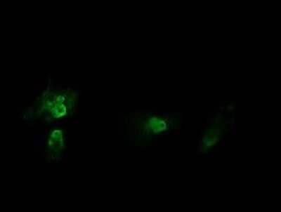 Immunocytochemistry/Immunofluorescence: HRAS Antibody (OTI1D9) - Azide and BSA Free [NBP2-74847] - Analysis of HeLa cells.