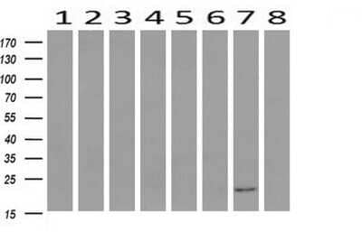 Western Blot: HRAS Antibody (OTI1D9) - Azide and BSA Free [NBP2-74847] - Analysis of extracts (10ug) from 8 Human tissue by using HRAS monoclonal antibody at 1:200 (1: Testis; 2: Uterus; 3: Breast; 4: Brain; 5: Liver; 6: Ovary; 7: Thyroid gland; 8: Colon).