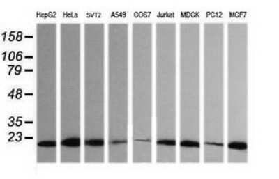 Western Blot: HRAS Antibody (OTI1D9) - Azide and BSA Free [NBP2-74847] - Analysis of extracts (35ug) from 9 different cell lines (HepG2: human; HeLa: human; SVT2: mouse; A549: human; COS7: monkey; Jurkat: human; MDCK: canine; PC12: rat; MCF7: human).