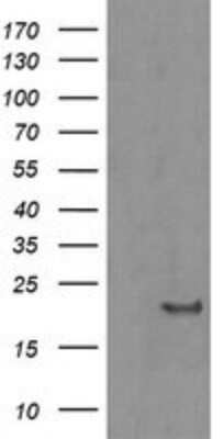 Western Blot: HRAS Antibody (OTI1D9) - Azide and BSA Free [NBP2-74847] - Analysis of HEK293T cells were transfected with the pCMV6-ENTRY control (Left lane) or pCMV6-ENTRY vH RAS.