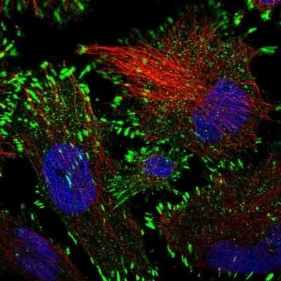 Immunocytochemistry/Immunofluorescence: HRAS like suppressor Antibody [NBP2-14101] - Immunofluorescent staining of human cell line U-251 MG shows localization to focal adhesion sites.