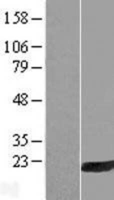 Western Blot: HRASLS3 Overexpression Lysate (Adult Normal) [NBP2-11125] Left-Empty vector transfected control cell lysate (HEK293 cell lysate); Right -Over-expression Lysate for HRASLS3.