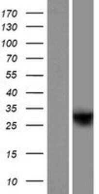 Western Blot: HRASLS5 Overexpression Lysate (Adult Normal) [NBP2-05808] Left-Empty vector transfected control cell lysate (HEK293 cell lysate); Right -Over-expression Lysate for HRASLS5.