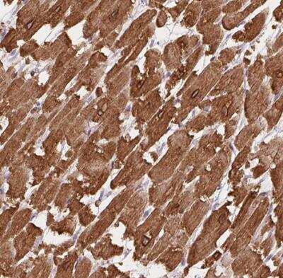 Immunohistochemistry-Paraffin: HRC Antibody [NBP1-81208] - Staining of human heart muscle shows high expression.