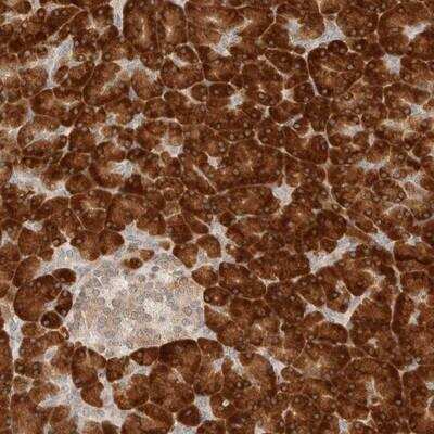 Immunohistochemistry: HRD1 Antibody [NBP1-89668] - Staining of human pancreas shows strong cytoplasmic positivity in exocrine glandular cells.
