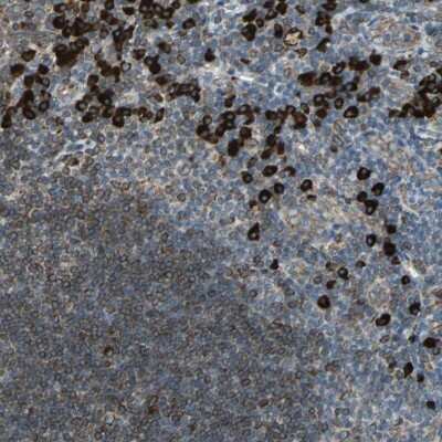 Immunohistochemistry-Paraffin: HRD1 Antibody [NBP1-89667] - Staining of human tonsil shows high expression.