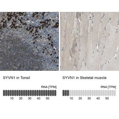 Immunohistochemistry-Paraffin: HRD1 Antibody [NBP1-89667] - Staining in human tonsil and skeletal muscle tissues using anti-SYVN1 antibody. Corresponding SYVN1 RNA-seq data are presented for the same tissues.