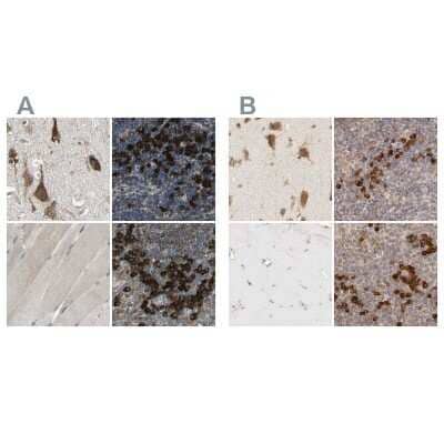 Immunohistochemistry-Paraffin: HRD1 Antibody [NBP1-89667] - Staining of human cerebral cortex, lymph node, skeletal muscle and tonsil using Anti-SYVN1 antibody NBP1-89667 (A) shows similar protein distribution across tissues to independent antibody NBP1-89668 (B).