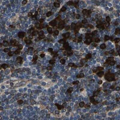 Immunohistochemistry-Paraffin: HRD1 Antibody [NBP1-89667] - Staining of human lymph node.