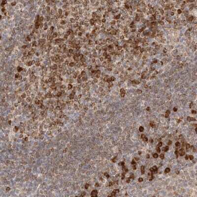 Immunohistochemistry-Paraffin: HRD1 Antibody [NBP1-89668] - Staining of human tonsil shows high expression.