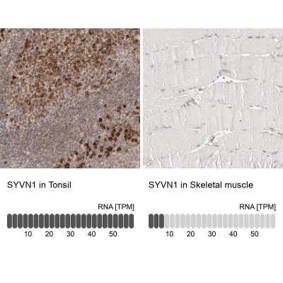 <b>Orthogonal Strategies Validation. </b>Immunohistochemistry-Paraffin: HRD1 Antibody [NBP1-89668] - Staining in human tonsil and skeletal muscle tissues using anti-SYVN1 antibody. Corresponding SYVN1 RNA-seq data are presented for the same tissues.