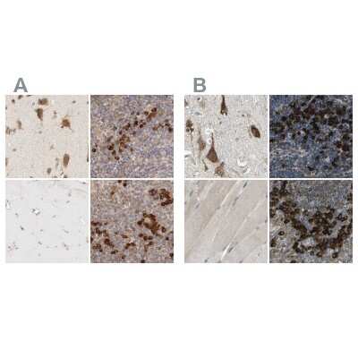 <b>Independent Antibodies Validation. </b>Immunohistochemistry-Paraffin: HRD1 Antibody [NBP1-89668] - Staining of human cerebral cortex, lymph node, skeletal muscle and tonsil using Anti-SYVN1 antibody NBP1-89668 (A) shows similar protein distribution across tissues to independent antibody NBP1-89667 (B).