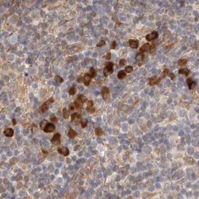 Immunohistochemistry-Paraffin: HRD1 Antibody [NBP1-89668] - Staining of human lymph node.