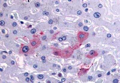 Immunohistochemistry-Paraffin: HRD1 Antibody [NBP3-06671] - HRD1 Antibody IHC of human liver. Immunohistochemistry of formalin-fixed, paraffin-embedded tissue after heat-induced antigen retrieval.