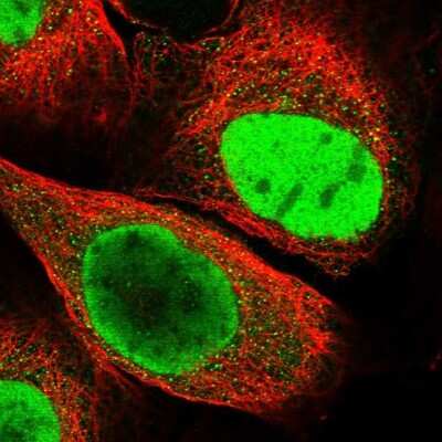 Immunocytochemistry/ Immunofluorescence HRP-2 Antibody - BSA Free