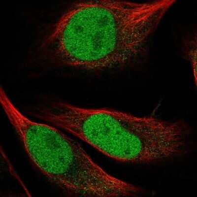 <b>Independent Antibodies Validation. </b>Immunocytochemistry/Immunofluorescence: HRP-2 Antibody [NBP2-47438] - Staining of human cell line U-2 OS shows localization to nucleoplasm. Antibody staining is shown in green.