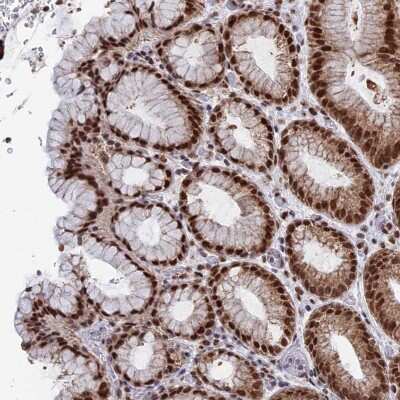 Immunohistochemistry HRP-2 Antibody - BSA Free