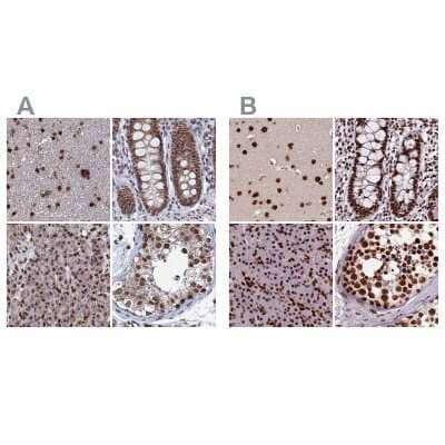 Immunohistochemistry-Paraffin HRP-2 Antibody - BSA Free