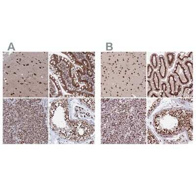 Immunohistochemistry-Paraffin: HRP-2 Antibody [NBP2-47437] - Staining of human cerebral cortex, gastrointestinal, pancreas and testis using Anti-CTB-50L17.10 antibody NBP2-47437 (A) shows similar protein distribution across tissues to independent antibody NBP2-47438 (B).
