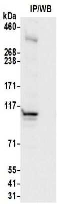 Immunoprecipitation: HRP-2 Antibody [NBP2-32069] - Samples: Whole cell lysate (0.5 or 1.0 mg per IP reaction; 20% of IP loaded) from 293T cells.  Antibodies:  Affinity purified rabbit anti-HRP-2 antibody NBP2-32069 used for IP at 6 ug per reaction. For blotting immunoprecipitated HRP-2, NBP2-32069 was used at 1 ug/ml. Detection: Chemiluminescence with an exposure time of 10 seconds.