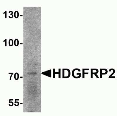 Western Blot: HRP-2 Antibody [NBP2-81994] - Analysis of HRP-2 in rat lung tissue lysate with HRP-2 antibody at 2 ug/ml.