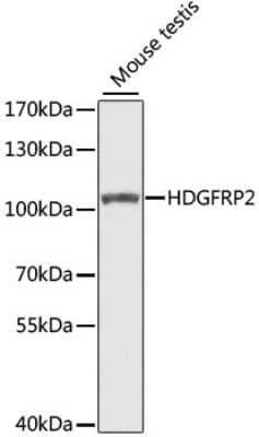 Western Blot: HRP-2 Antibody [NBP3-05607] - Western blot analysis of extracts of mouse testis, using HRP-2 antibody (NBP3-05607) at 1:1000 dilution. Secondary antibody: HRP Goat Anti-Rabbit IgG (H+L) at 1:10000 dilution. Lysates/proteins: 25ug per lane. Blocking buffer: 3% nonfat dry milk in TBST. Detection: ECL Basic Kit. Exposure time: 30s.