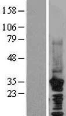 Western Blot: HRPT2 Overexpression Lysate (Adult Normal) [NBL1-09015] Left-Empty vector transfected control cell lysate (HEK293 cell lysate); Right -Over-expression Lysate for HRPT2.