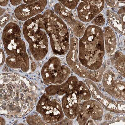 Immunohistochemistry-Paraffin HS1BP3 Antibody - BSA Free